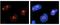 Nucleolin antibody, GTX47363, GeneTex, Immunocytochemistry image 