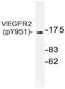 Kinase Insert Domain Receptor antibody, AP20911PU-N, Origene, Western Blot image 