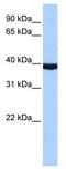 Paired Box 2 antibody, GTX30760, GeneTex, Western Blot image 