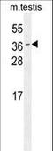 Outer Dense Fiber Of Sperm Tails 3 antibody, LS-C163106, Lifespan Biosciences, Western Blot image 