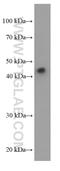 Orosomucoid 2 antibody, 66217-1-Ig, Proteintech Group, Western Blot image 