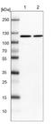 FES Proto-Oncogene, Tyrosine Kinase antibody, NBP1-83429, Novus Biologicals, Western Blot image 