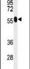 Acyl-CoA Synthetase Medium Chain Family Member 1 antibody, PA5-26292, Invitrogen Antibodies, Western Blot image 