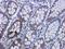 Glypican 3 antibody, orb378084, Biorbyt, Immunohistochemistry paraffin image 