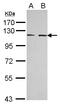 EPH Receptor A3 antibody, LS-C155360, Lifespan Biosciences, Western Blot image 