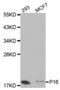 Cyclin-dependent kinase inhibitor 2A, isoforms 1/2/3 antibody, abx000647, Abbexa, Western Blot image 