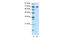 Interleukin Enhancer Binding Factor 3 antibody, 28-985, ProSci, Immunohistochemistry paraffin image 