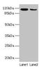 ATPase Sarcoplasmic/Endoplasmic Reticulum Ca2+ Transporting 2 antibody, LS-C369284, Lifespan Biosciences, Western Blot image 