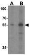 POU Class 2 Homeobox 3 antibody, GTX17217, GeneTex, Western Blot image 