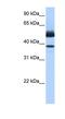 Lipase Family Member J antibody, NBP1-70602, Novus Biologicals, Western Blot image 