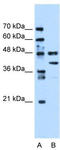 Eukaryotic Translation Elongation Factor 1 Gamma antibody, TA346548, Origene, Western Blot image 
