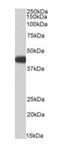 Acyl-CoA Dehydrogenase Medium Chain antibody, orb334068, Biorbyt, Western Blot image 