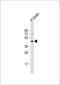 Gamma-Aminobutyric Acid Type A Receptor Rho3 Subunit (Gene/Pseudogene) antibody, 56-407, ProSci, Western Blot image 