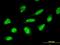 Zinc Finger Protein 396 antibody, MA5-23205, Invitrogen Antibodies, Immunofluorescence image 