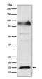 ISG15 Ubiquitin Like Modifier antibody, M00554, Boster Biological Technology, Western Blot image 