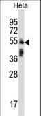 Tripartite Motif Containing 38 antibody, LS-C160192, Lifespan Biosciences, Western Blot image 