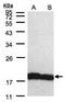 Peptidylprolyl Isomerase A antibody, PA5-28089, Invitrogen Antibodies, Western Blot image 