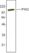 Protein Tyrosine Kinase 2 Beta antibody, LS-B1892, Lifespan Biosciences, Western Blot image 