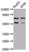 Germ Cell Nuclear Acidic Peptidase antibody, CSB-PA836285LA01HU, Cusabio, Western Blot image 