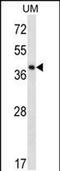 Speckle Type BTB/POZ Protein Like antibody, PA5-48444, Invitrogen Antibodies, Western Blot image 