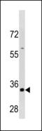Cyclin B3 antibody, LS-C203891, Lifespan Biosciences, Western Blot image 