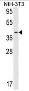 Calponin 3 antibody, AP17170PU-N, Origene, Western Blot image 