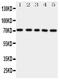 ATP Binding Cassette Subfamily G Member 2 (Junior Blood Group) antibody, PA1869, Boster Biological Technology, Western Blot image 