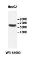 Pyruvate Dehydrogenase Kinase 3 antibody, orb77909, Biorbyt, Western Blot image 