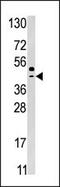 Selenide, water dikinase 2 antibody, 62-714, ProSci, Western Blot image 