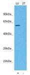 Frizzled Class Receptor 4 antibody, GTX01572, GeneTex, Western Blot image 