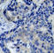 Protein Tyrosine Kinase 2 Beta antibody, AP0214, ABclonal Technology, Immunohistochemistry paraffin image 