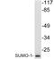 Small Ubiquitin Like Modifier 1 antibody, LS-C176352, Lifespan Biosciences, Western Blot image 