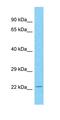 Extracellular Matrix Protein 2 antibody, orb326550, Biorbyt, Western Blot image 