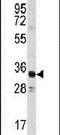 Annexin A3 antibody, PA5-12439, Invitrogen Antibodies, Western Blot image 