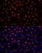 Actinin Alpha 3 (Gene/Pseudogene) antibody, LS-C747869, Lifespan Biosciences, Immunofluorescence image 