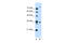 Transmembrane Protein 231 antibody, 31-374, ProSci, Western Blot image 