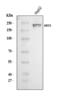 ATP Binding Cassette Subfamily C Member 3 antibody, A02429-1, Boster Biological Technology, Western Blot image 
