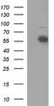 Interleukin 10 Receptor Subunit Alpha antibody, LS-C788363, Lifespan Biosciences, Western Blot image 