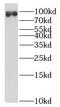 Prospero Homeobox 1 antibody, FNab06810, FineTest, Western Blot image 