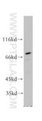 Replication Protein A1 antibody, 12448-1-AP, Proteintech Group, Western Blot image 