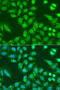 Histone Deacetylase 4 antibody, 23-304, ProSci, Immunofluorescence image 