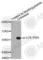 LCK Proto-Oncogene, Src Family Tyrosine Kinase antibody, AP0285, ABclonal Technology, Western Blot image 