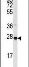 Phospholipid Phosphatase 2 antibody, PA5-12401, Invitrogen Antibodies, Western Blot image 