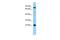 Mediator Complex Subunit 22 antibody, PA5-45836, Invitrogen Antibodies, Western Blot image 