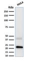 Ferritin Light Chain antibody, GTX34724, GeneTex, Western Blot image 