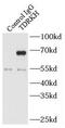 Tudor and KH domain-containing protein antibody, FNab08580, FineTest, Immunoprecipitation image 