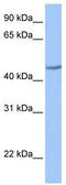 Zinc Finger Protein 485 antibody, TA341463, Origene, Western Blot image 