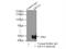 Keratin 14 antibody, 10143-1-AP, Proteintech Group, Immunoprecipitation image 