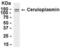 Ceruloplasmin antibody, XW-7698, ProSci, Enzyme Linked Immunosorbent Assay image 