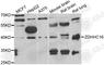 Zinc Finger DHHC-Type Containing 16 antibody, A7226, ABclonal Technology, Western Blot image 